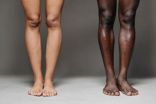 Ortesis de pierna y rodillas