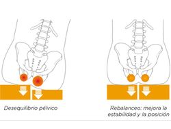 Cojín antiescaras de aire con 2 válvulas POLYAIR®. C6 C10