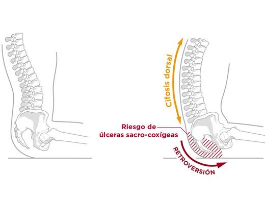 Cojín antiescaras viscoelástico postural.