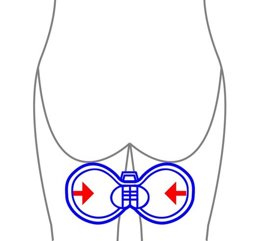 Entrenador suelo pelvico