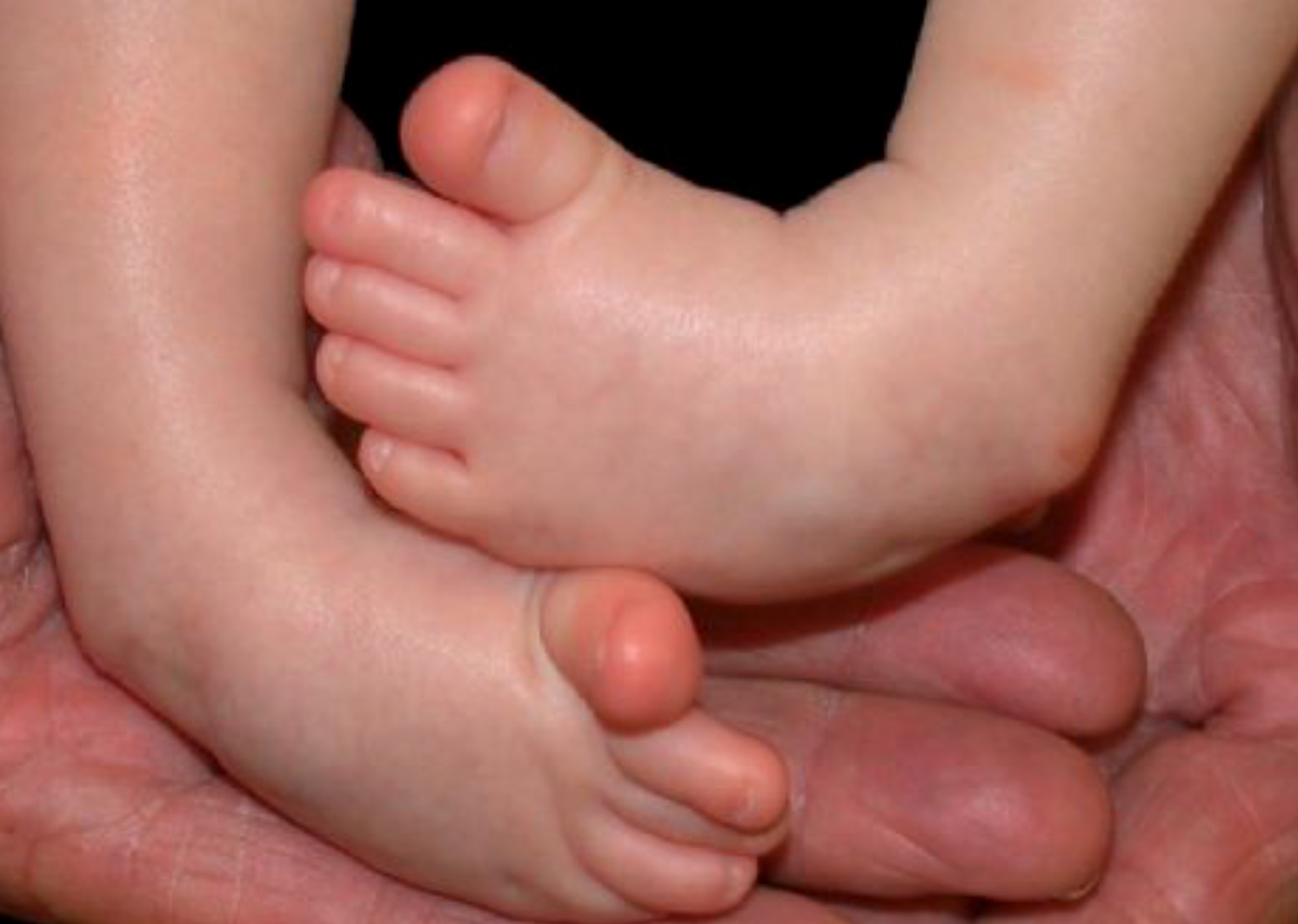 Ortesis de IOWA 000 / CON BARRA