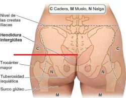 Ortesis Spinomed ®