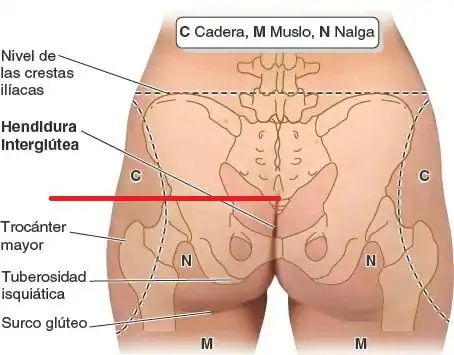 Ortesis Spinomed ®