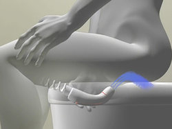 Bidet portátil HELLO BIDET
